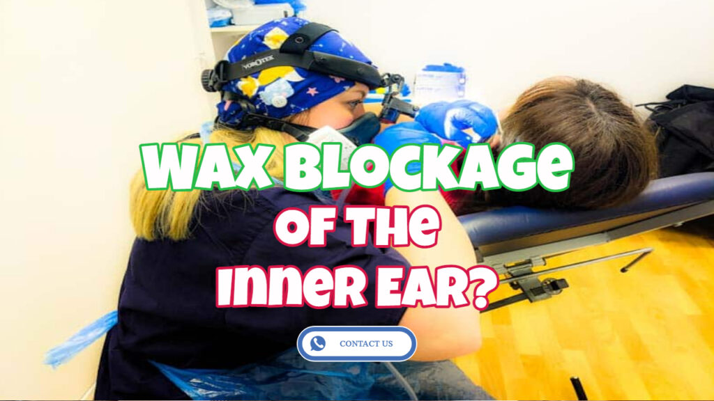 wax blockage of the inner ear