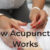 How Acupuncture Can Help You Improve Your Health