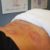 Sports Recovery Acupuncture: Explore 6 Key Advantages