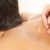 Effective Sports Recovery Solutions: Acupuncture and Cupping